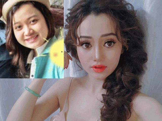 Mặt xinh như búp bê của hot girl dao kéo đà lạt nam định